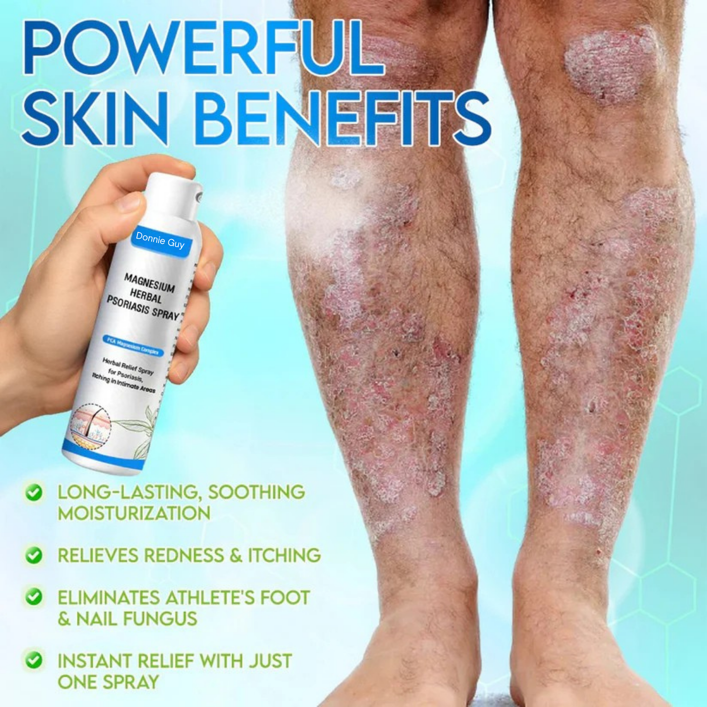 Magnesium Herbal Psoriasis Spray