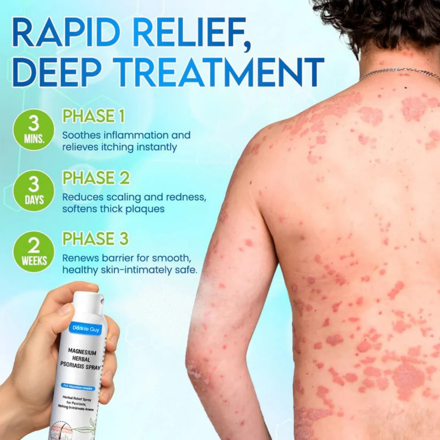 Magnesium Herbal Psoriasis Spray