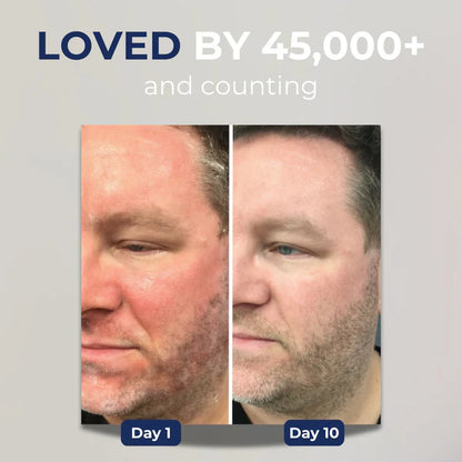 Advanced Restore Cream