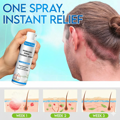 Magnesium Herbal Psoriasis Spray