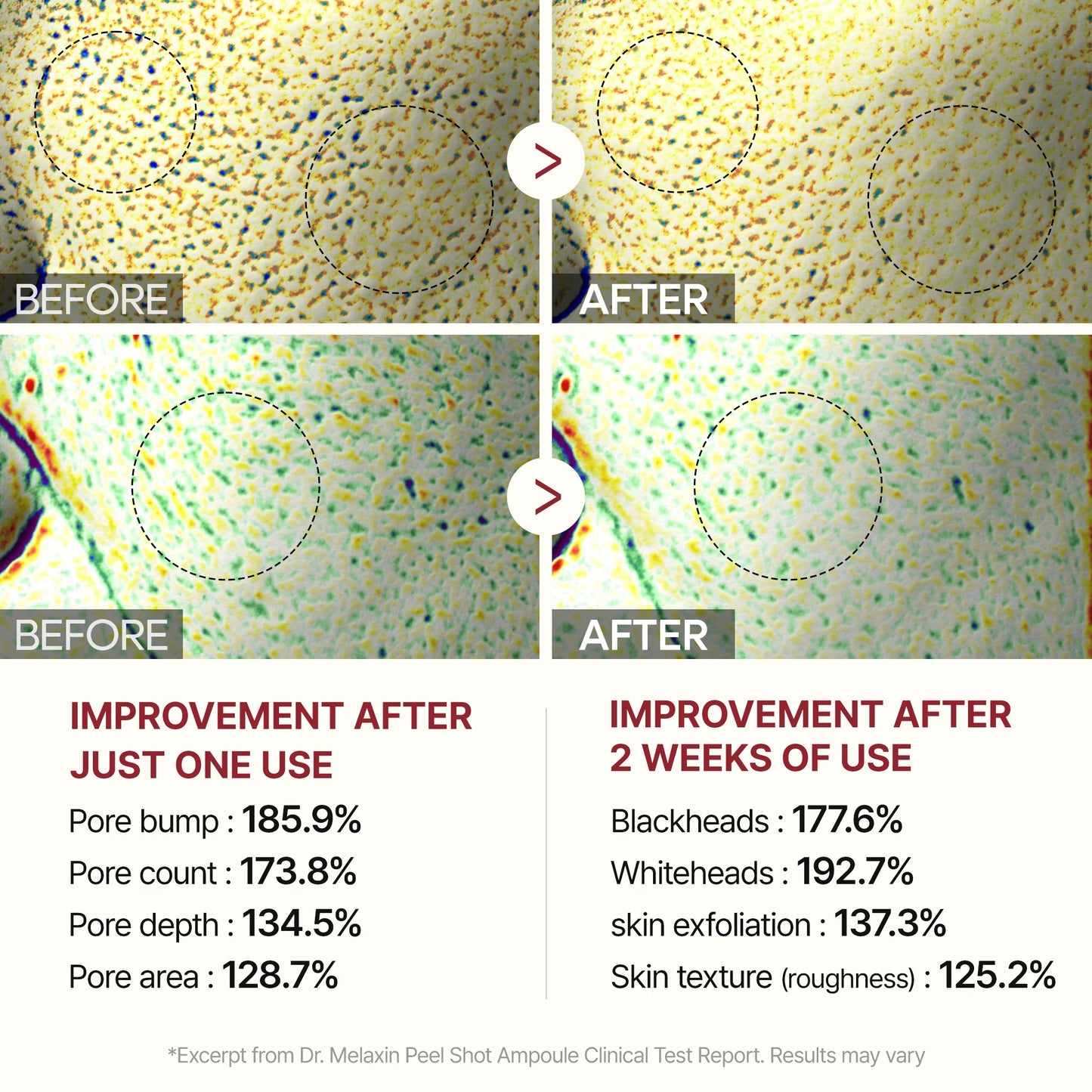 Drmark Peel Shot Glow Black Rice Ampoule