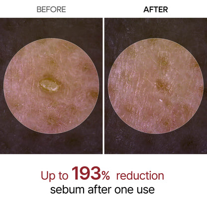 Drmark Peel Shot Glow Black Rice Ampoule