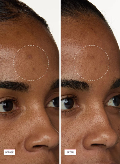 Smoothing Solution Ingrown Hair Treatment - Buy Two Get One Free