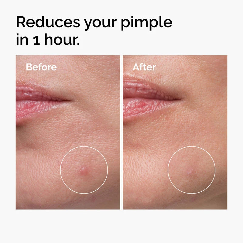 Sulfur 10% Powder-to-Cream Concentrate